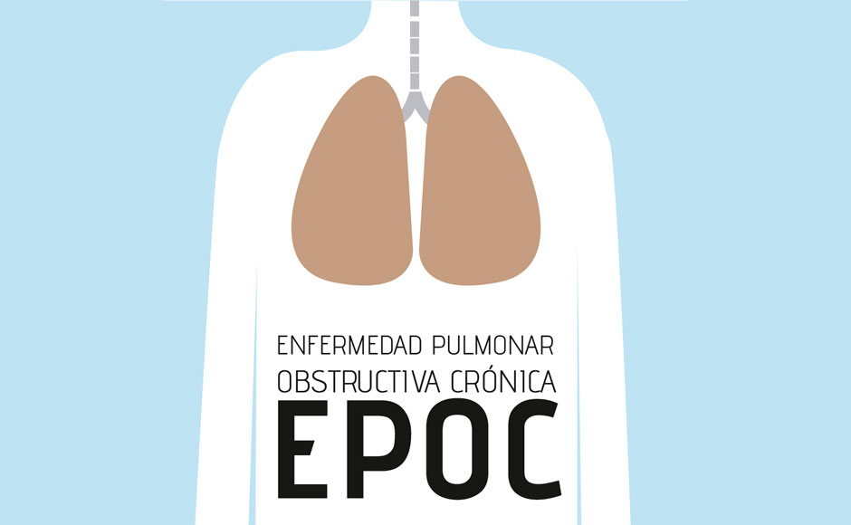 Enfermedad Pulmonar Obstructiva Crónica - EPOC